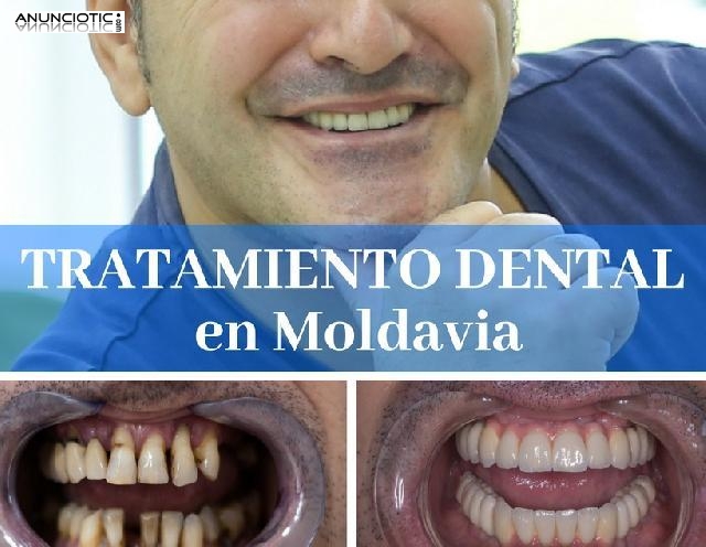Precio implante dental completo - 400 euro (implante dental + corona dental