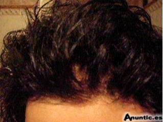 La mejores protesis capilares y pelucas invisibles de Espa&ntilde;a