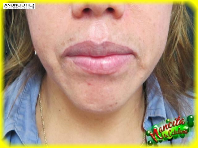 DONDE ME QUITO UN TATUAJE FACIAL???