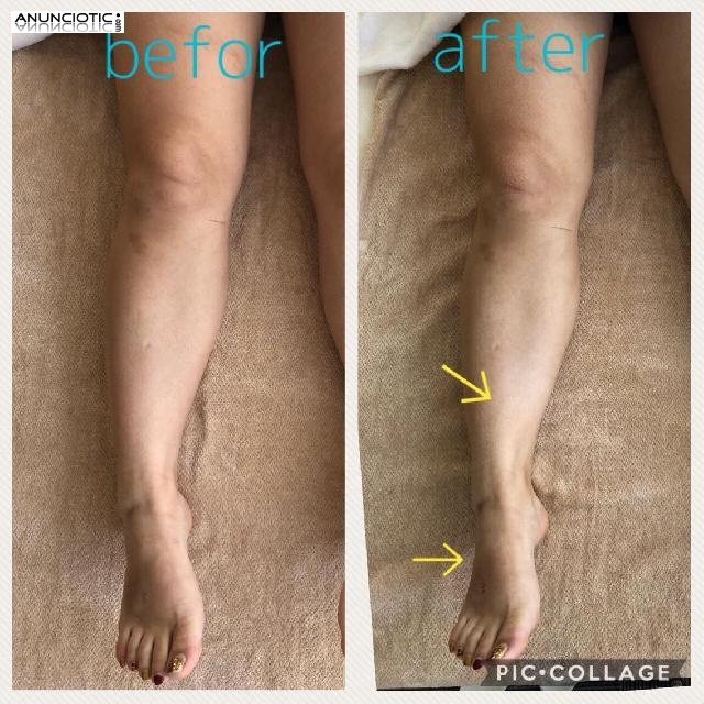 mejore tu circulaci&oacute;n!!!!!