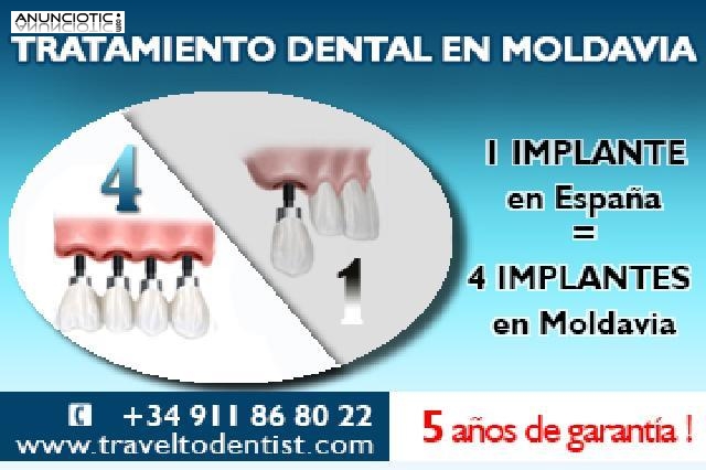 &iexcl;Tratamientos dentales a precios convenientes en Moldavia! 