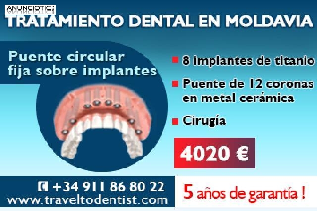 Pr&oacute;tesis fija sobre implantes a un precio incre&iacute;ble!  