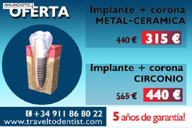 La mejor oferta para los implantes s&oacute;lo en nuestra cl&iacute;nica de Moldavia