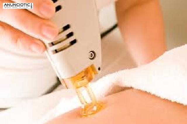 CURSO DE FOTODEPILACION con practicas, matr&iacute;cula GRATIS.