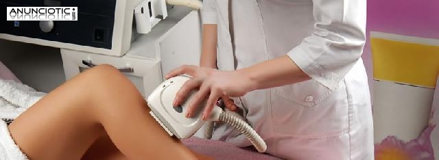 OLV&Iacute;DATE PARA SIEMPRE DEL VELLO