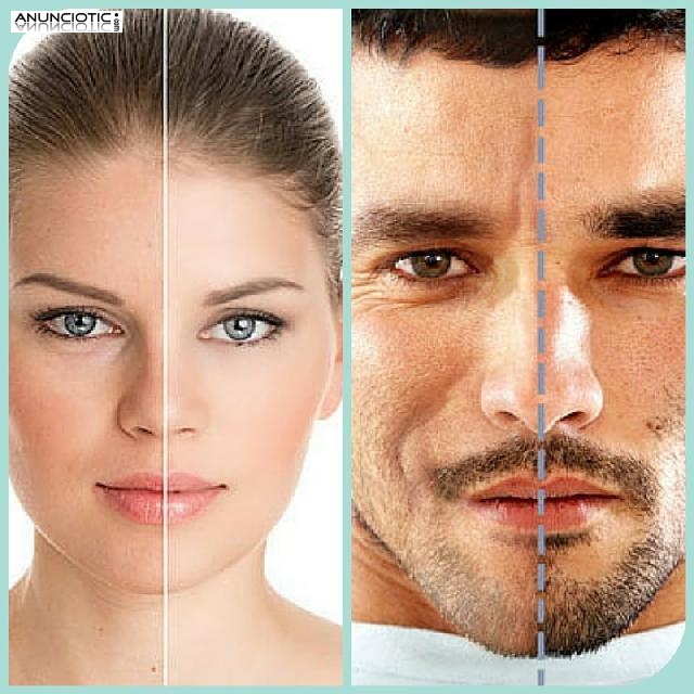 Fotorejuvenecimiento en La Estheticien, la mejor est&eacute;tica de Madrid