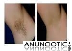 Depilaci&oacute;n con cera, depilaci&oacute;n permanente, depilaci&oacute;n definitiva, depilacion laser diodo 
