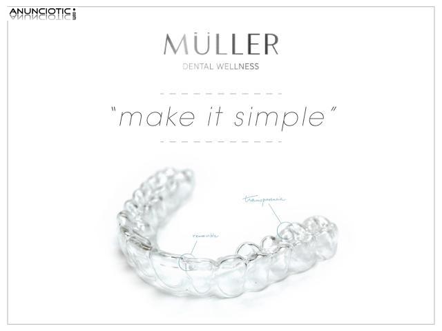 Implantes en 24 horas en Cl&iacute;nica Muller