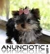 Adorable Teacup Yorkie cachorros para su aprobaci&oacute;n